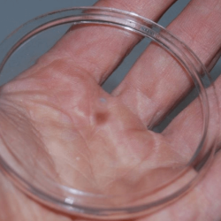 TRANSPARENT POLYESTER RESIN OCCLUSIONS